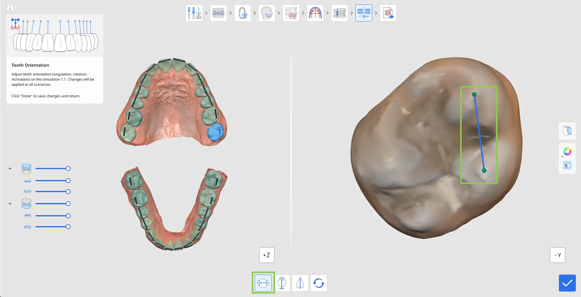 MOS How to Use Tooth Orientation 1.webp