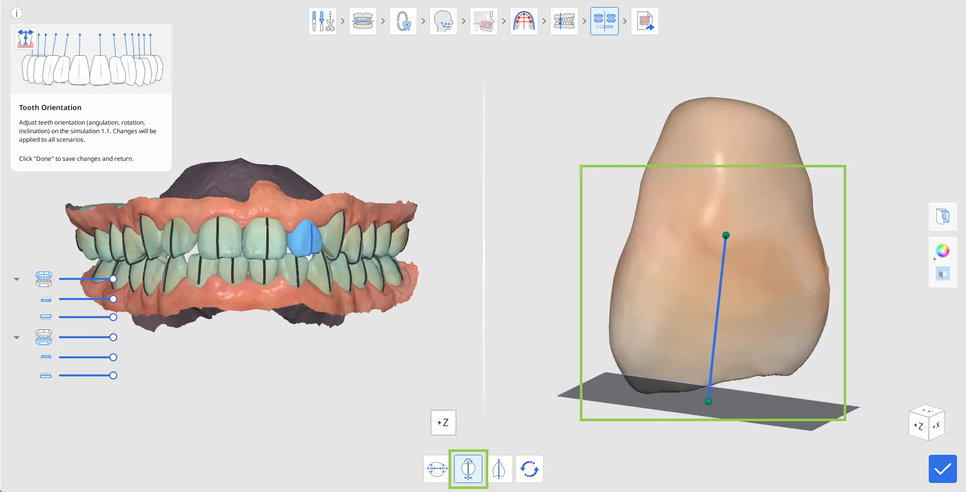 MOS How to Use Tooth Orientation 2.webp