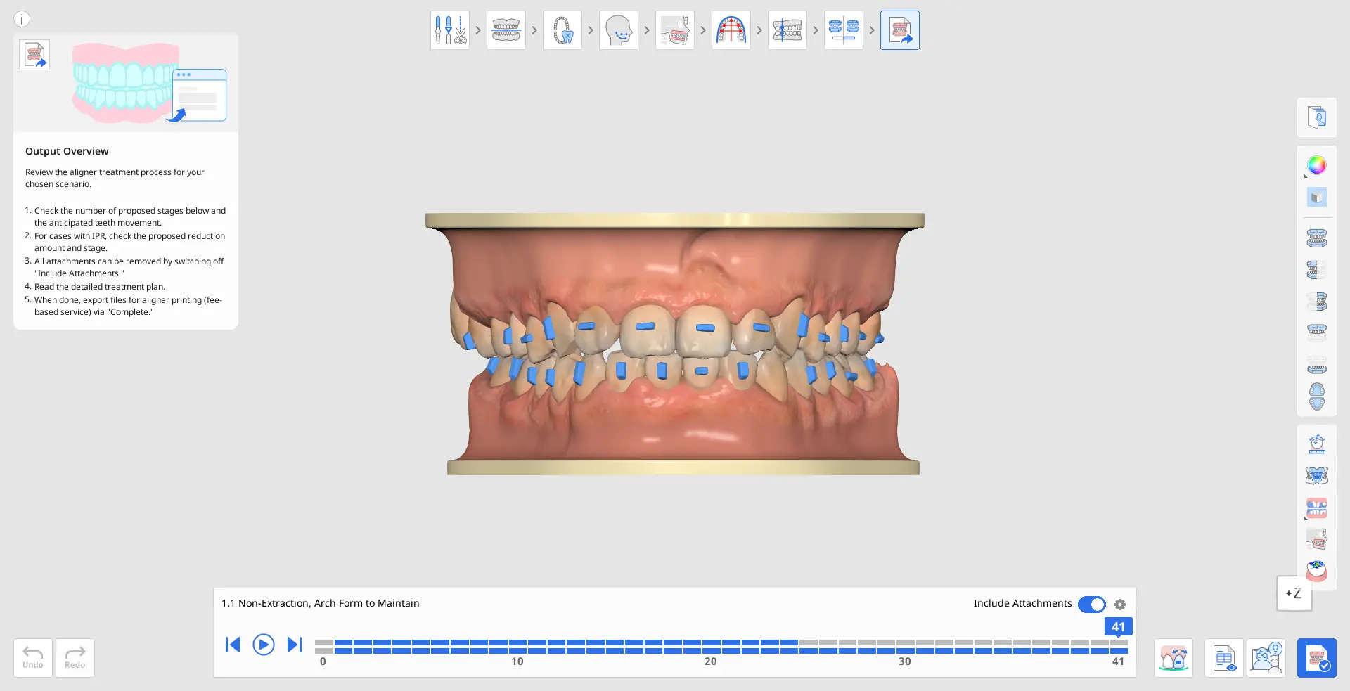 MOS Aligners.webp