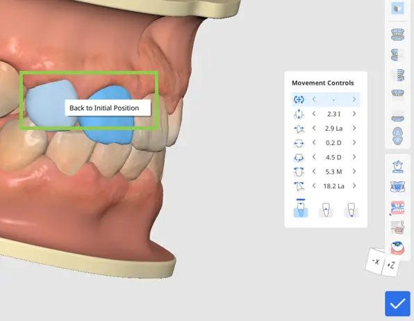 MOS Move Teeth 3.webp