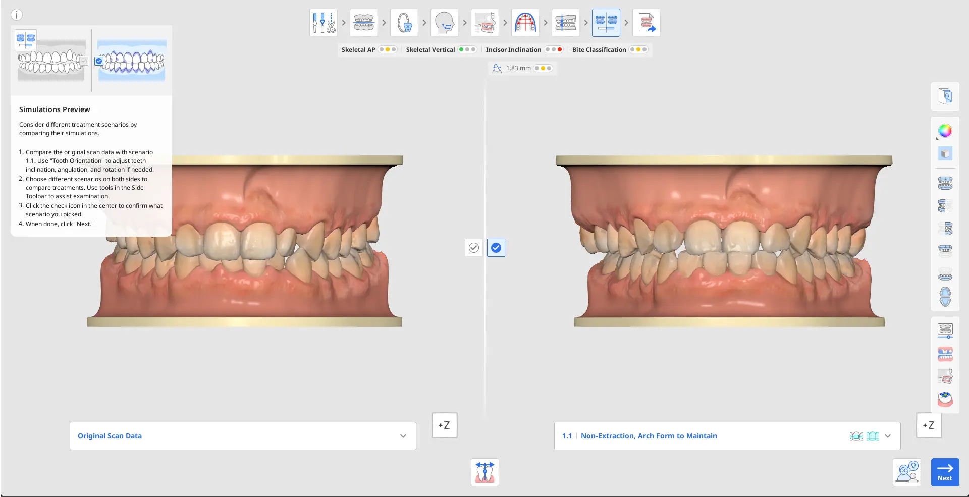 MOS Simulations Preview.webp