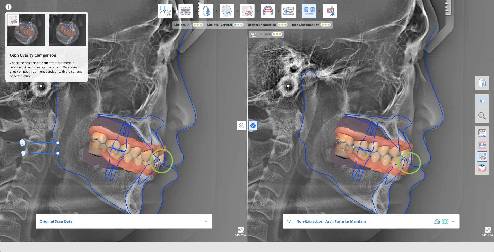 MOS Simulations Preview 3 3.webp
