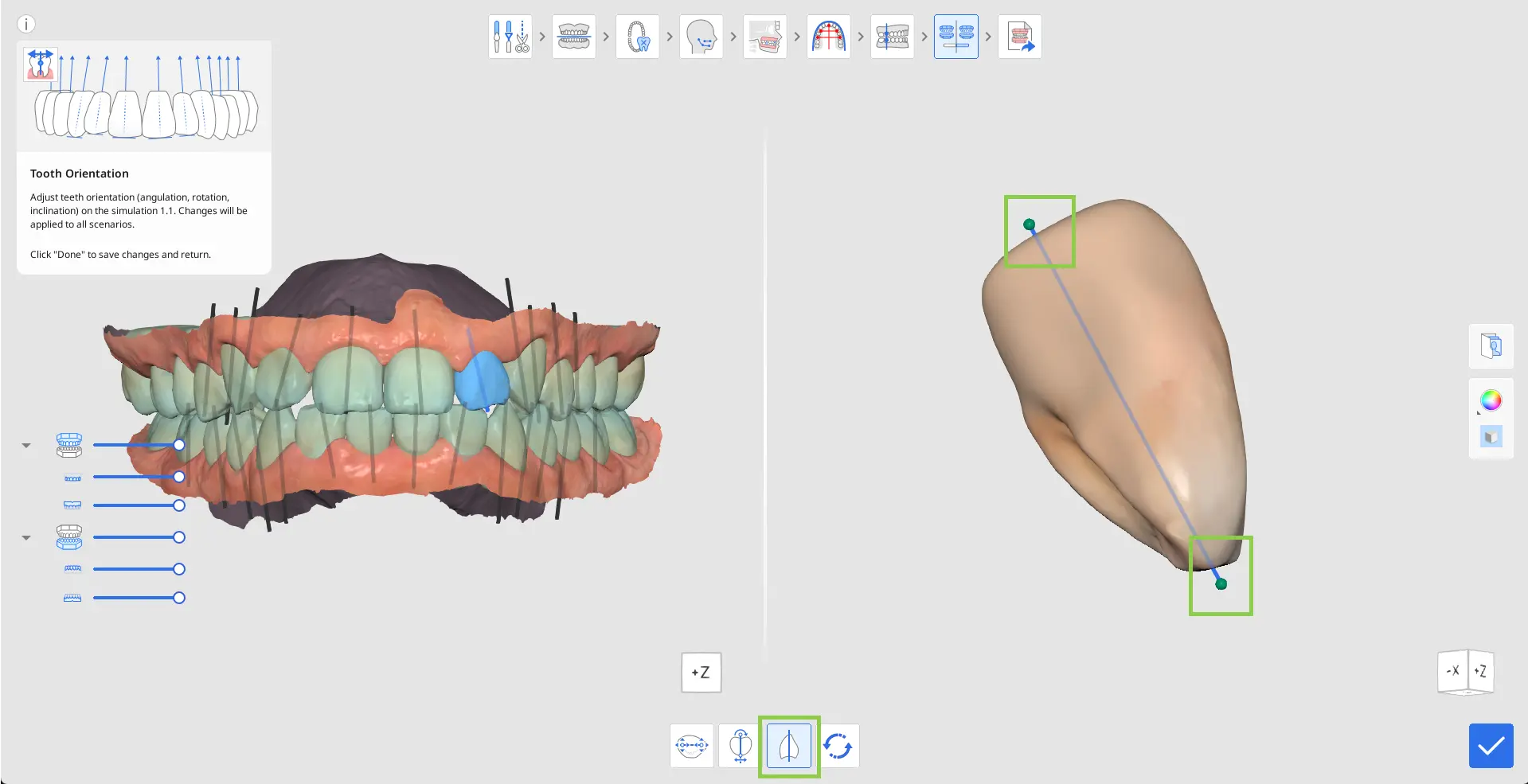 MOS How to Use Tooth Orientation 3.webp