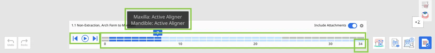 MOS Aligners 1.webp