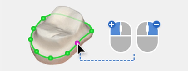 Use the Margin Line Imported from Medit Scan for Clinics.jpg