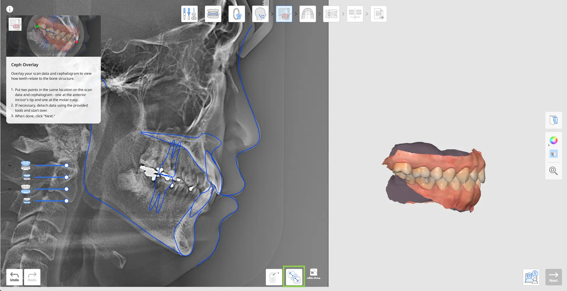 MOS Ceph Overlay 1.webp