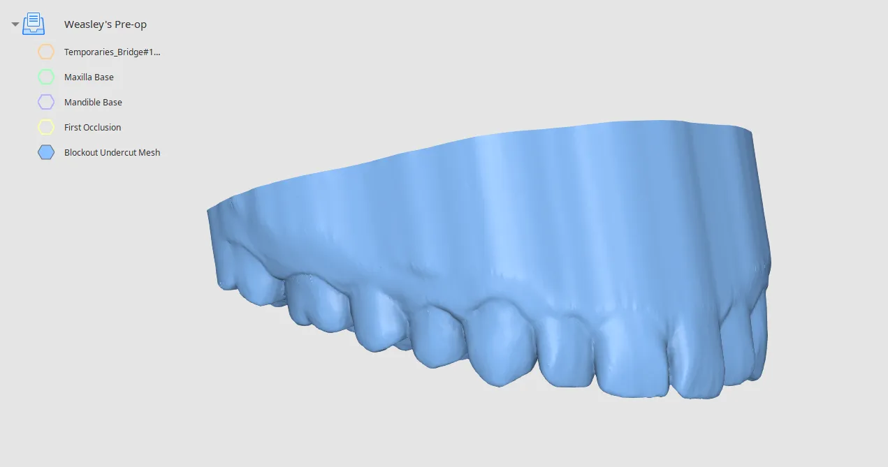 Blockout undercut mesh created 1.webp