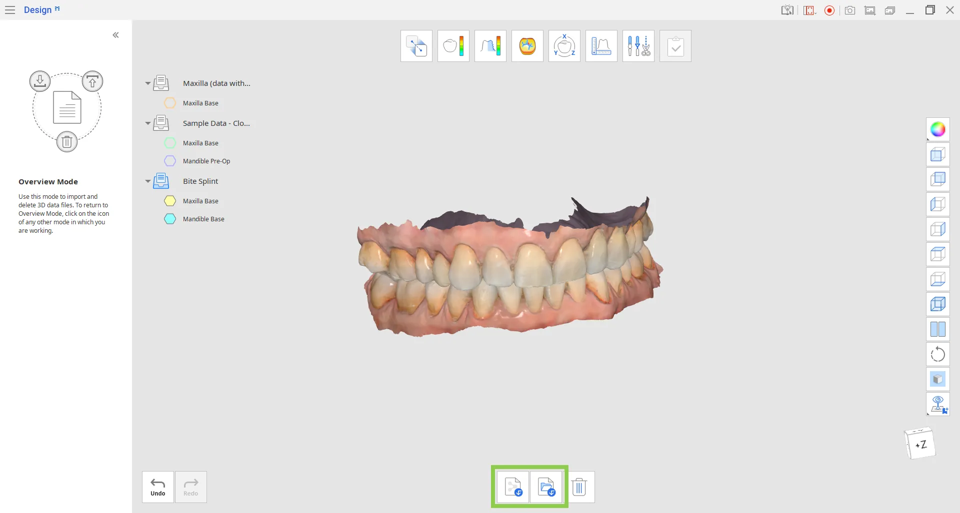 Overview Mode.webp