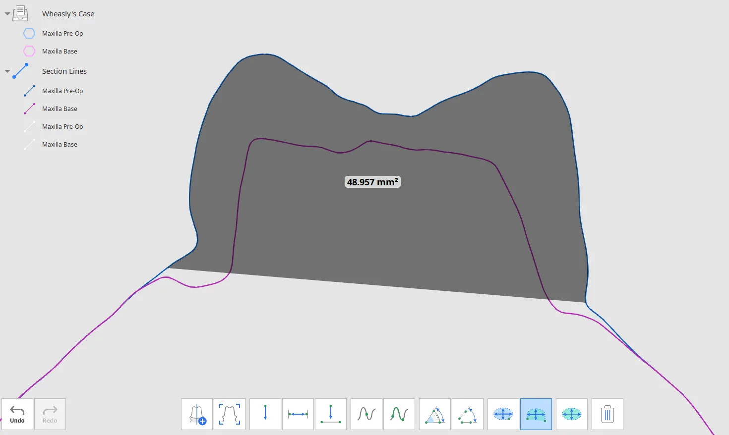 How to Use Measurement Mode 7.webp
