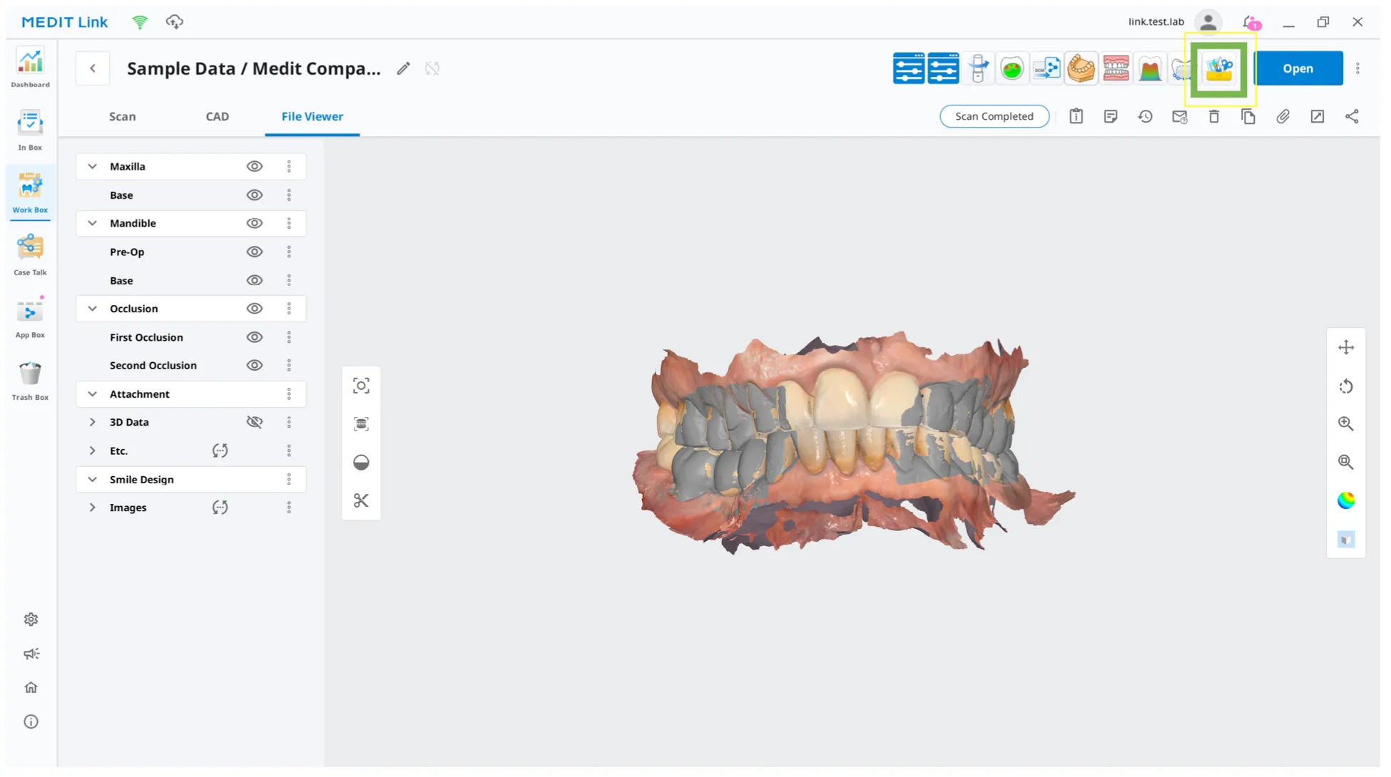 Running Medit Design from Medit Link 2.webp