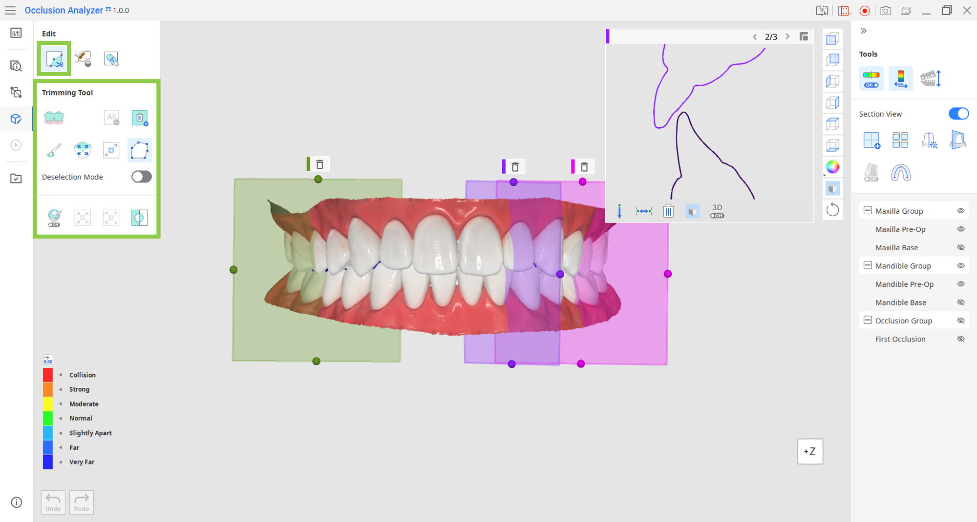 trim_data.png