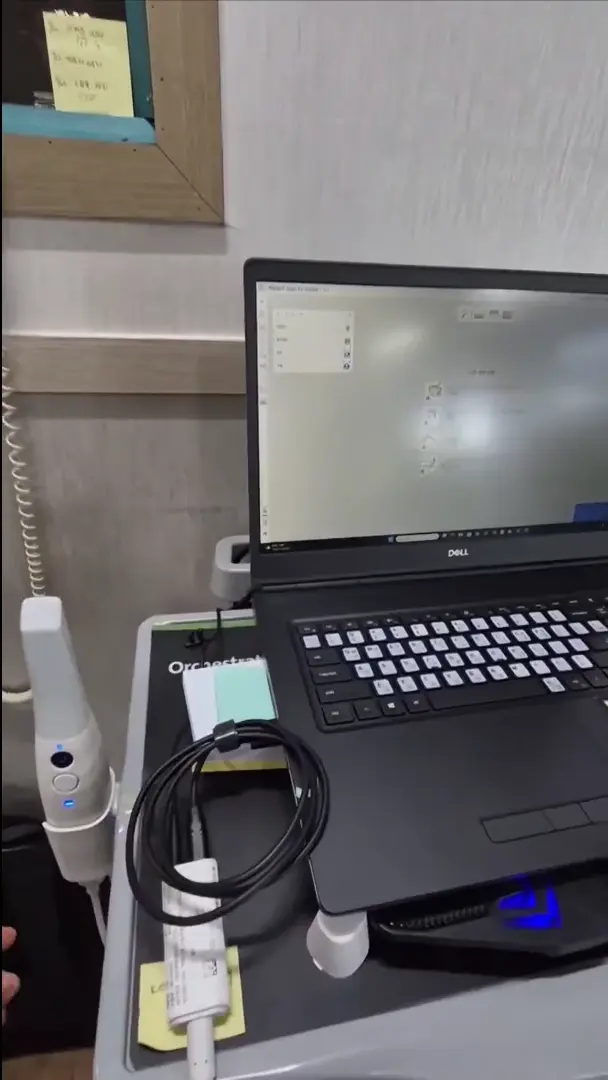 [i600 i700] PD Cable broken.webp