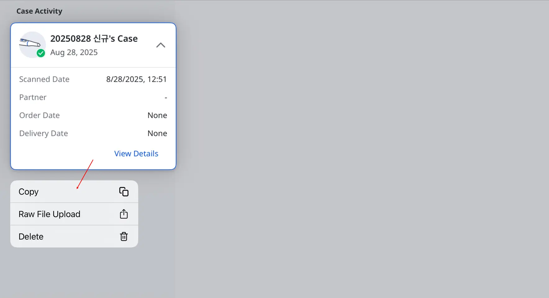 Express edit delete 5.webp