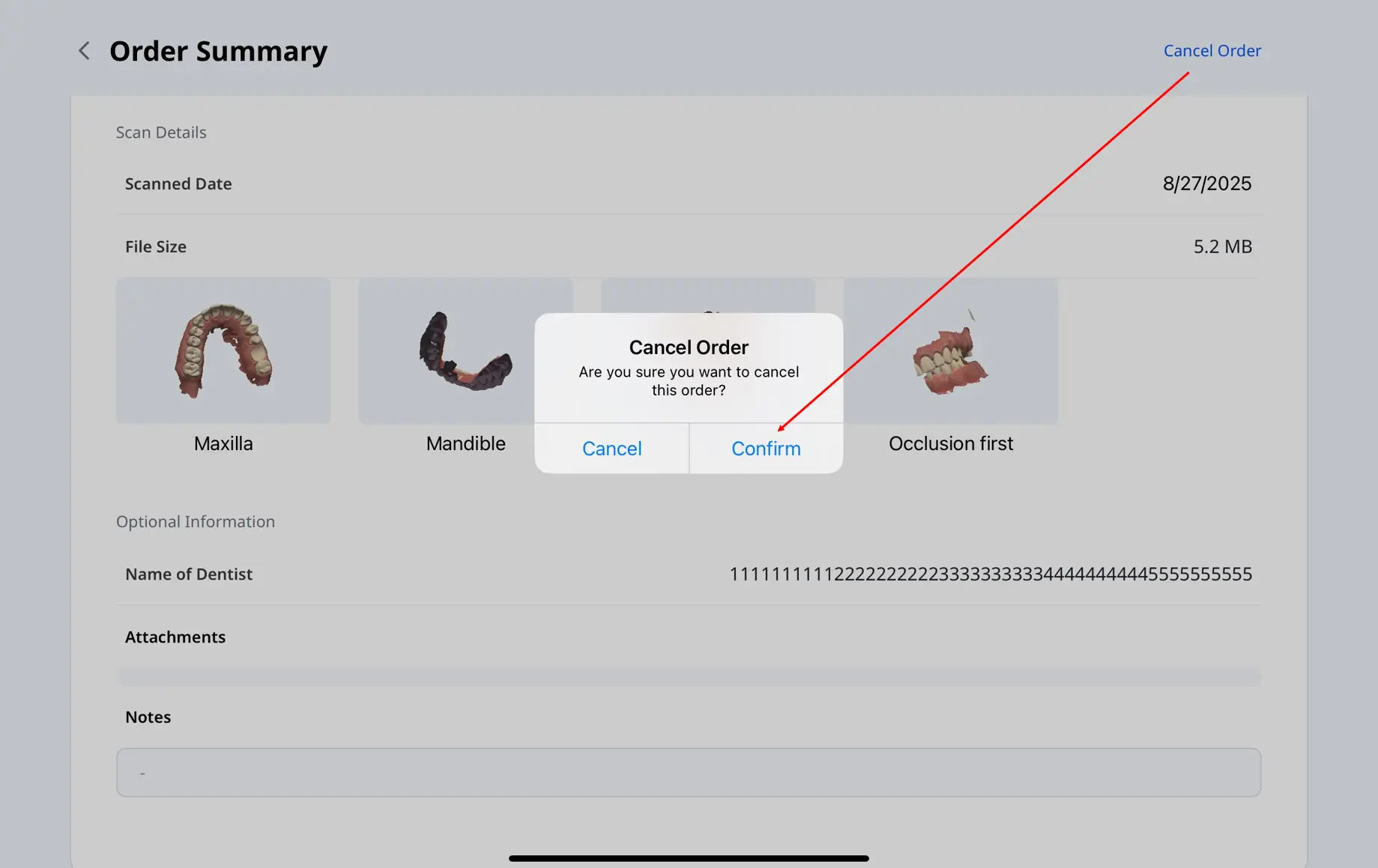 Checking Ordered Cases (1).webp