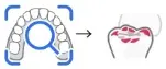 Occlusion Analysis (1).webp