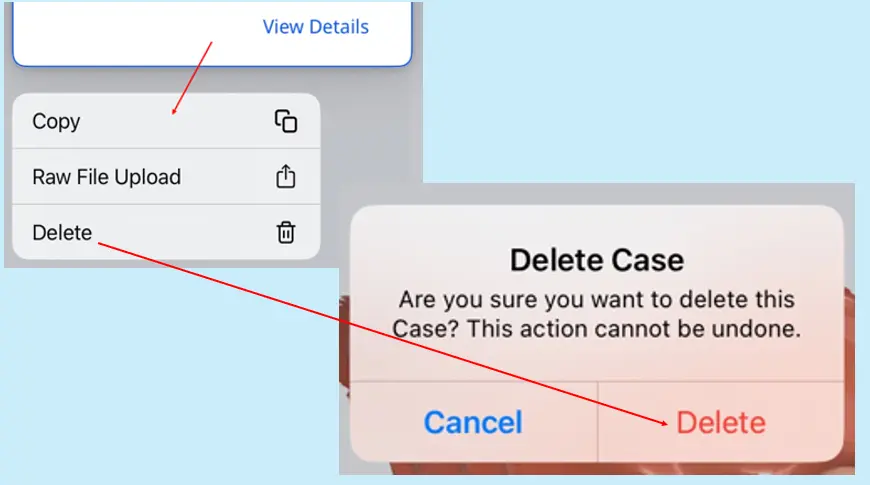 Express delete.webp