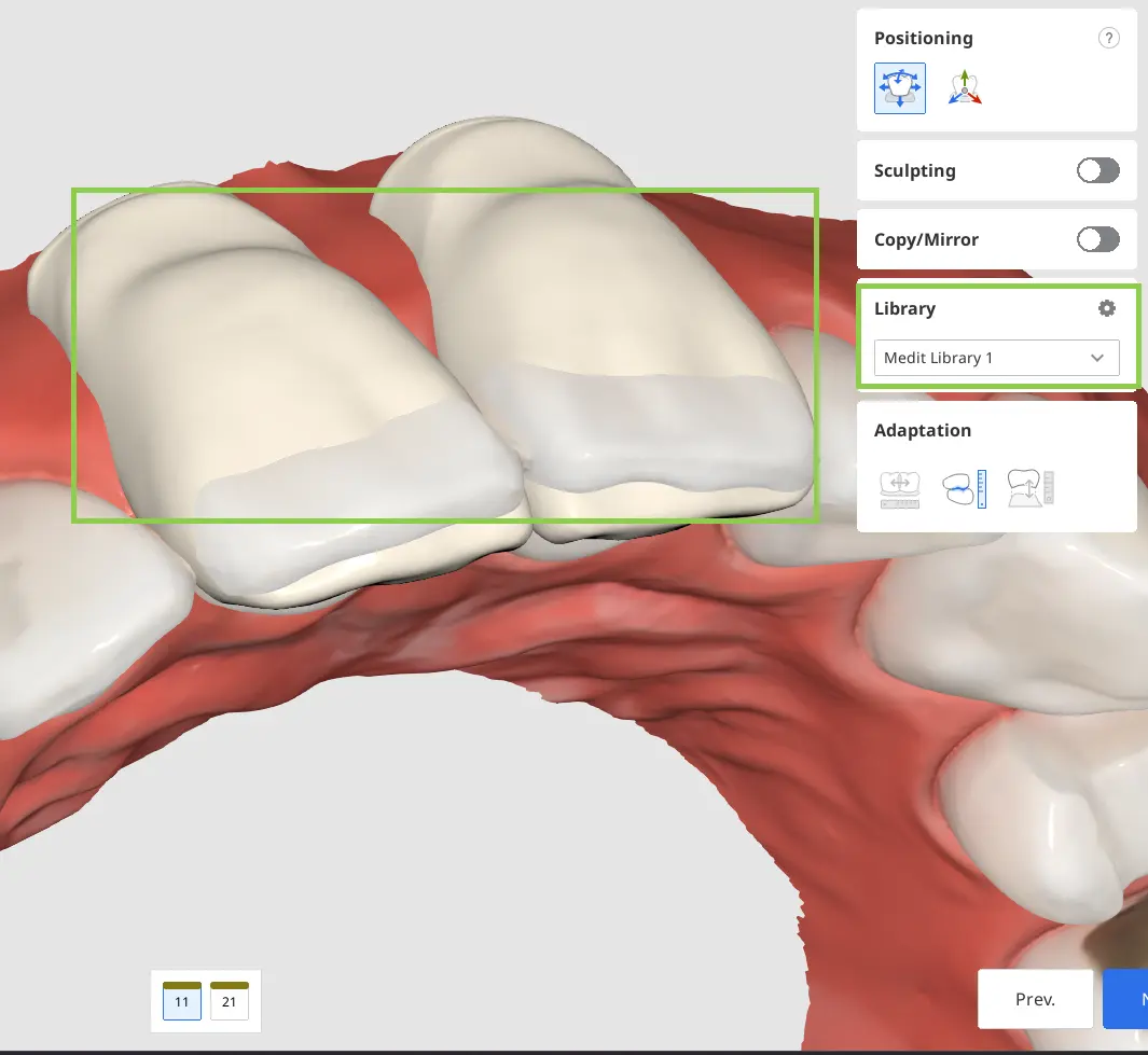 Diagnostic Wax-Up Module 4.webp