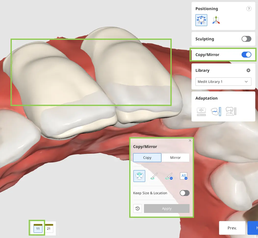 Diagnostic Wax-Up Module 4 1.webp