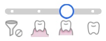 Edentulous.jpg