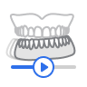 Dynamic Occlusion.png
