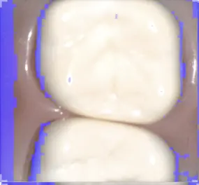 Clean Live View.webp