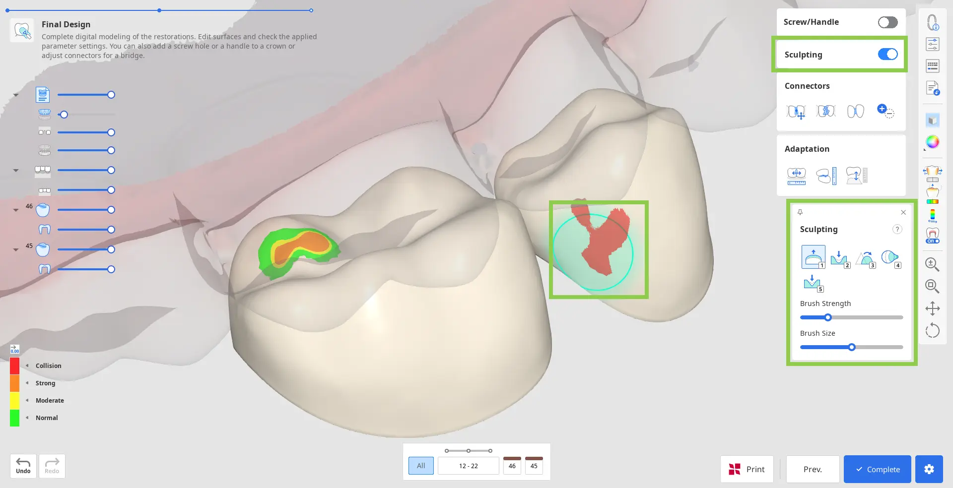 Pre Op final_design_2.webp