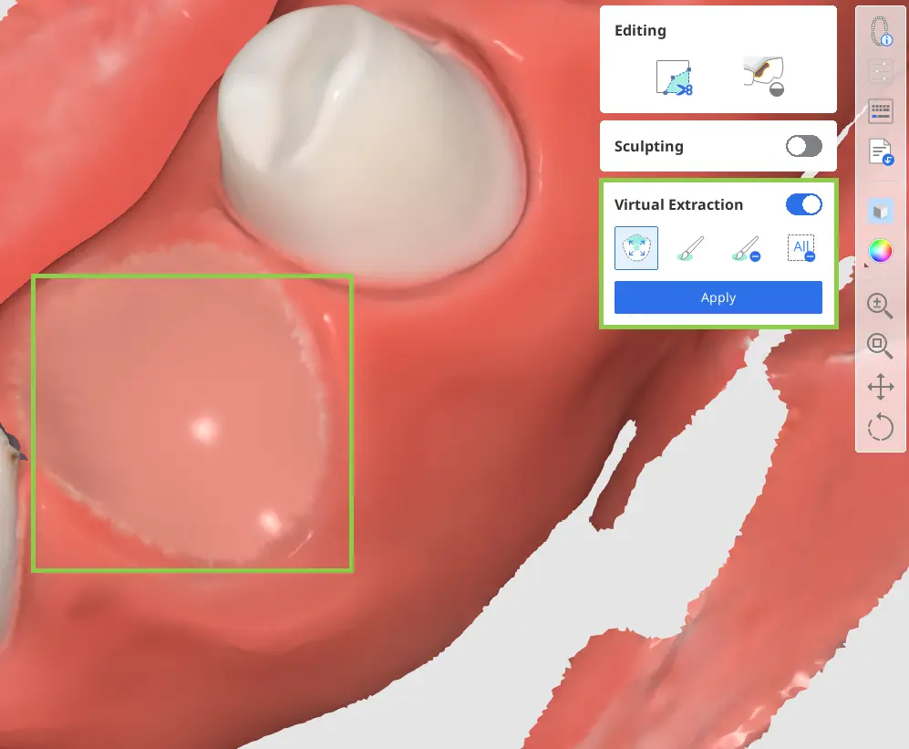 How to extract teeth.webp