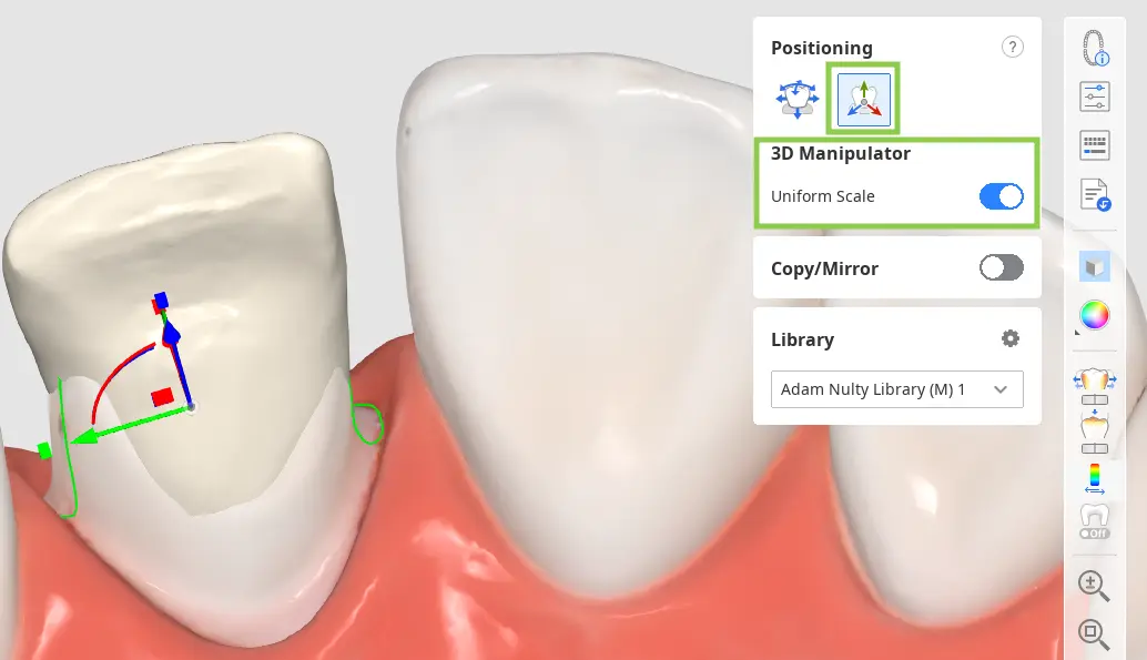 Prepared tooth_data_3 2.webp