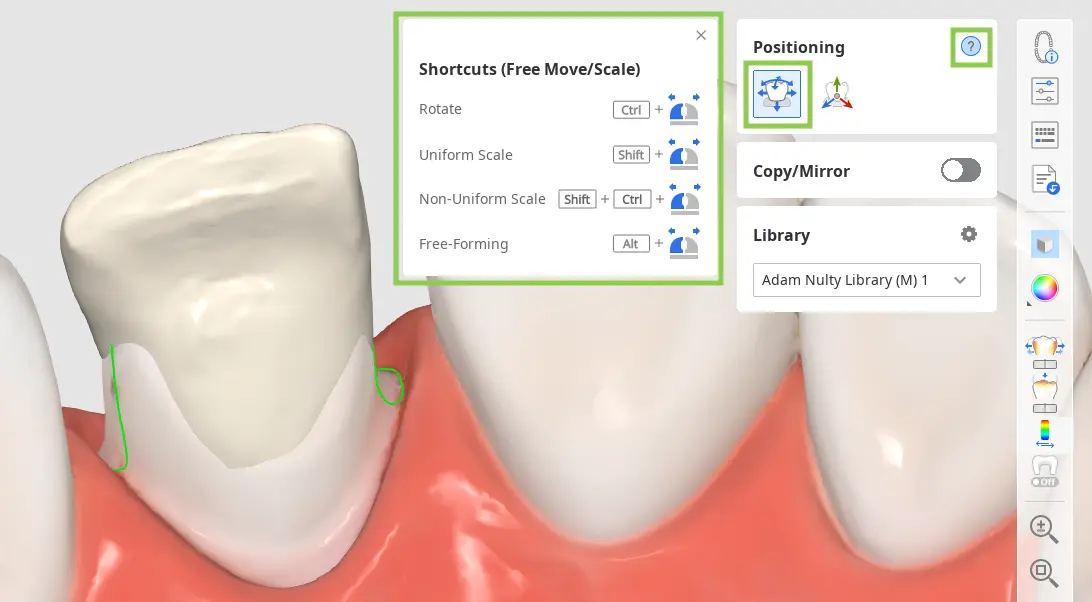 Prepared tooth_data_3 1.webp