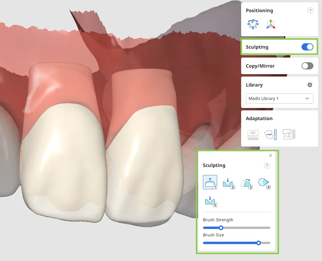 Diagnostic Wax-Up Module 6.webp