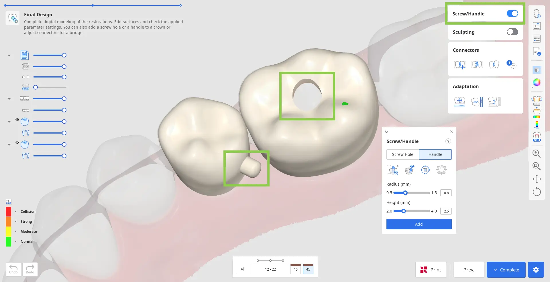 Pre Op final_design_5 1.webp