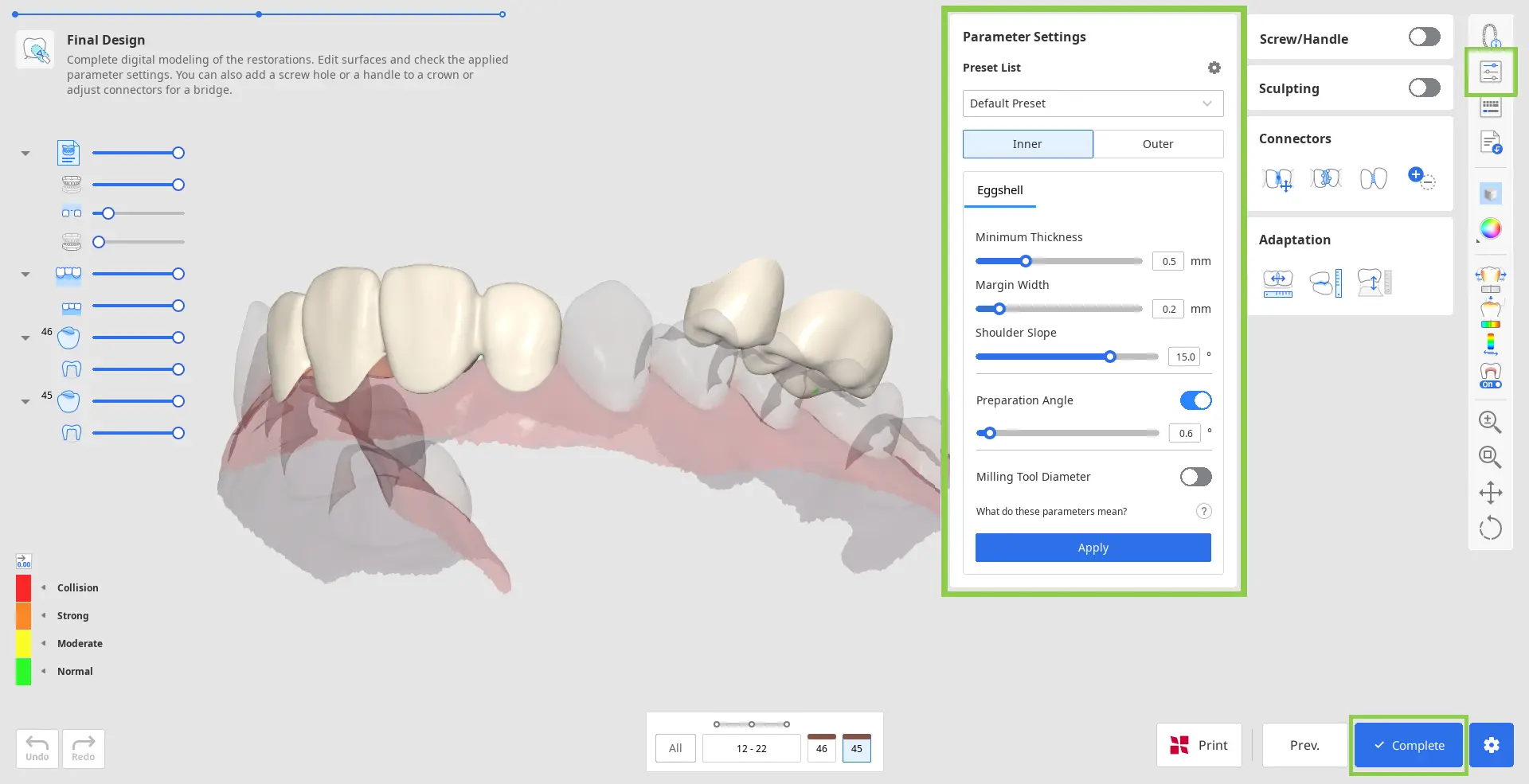 Pre Op final_design_6.webp