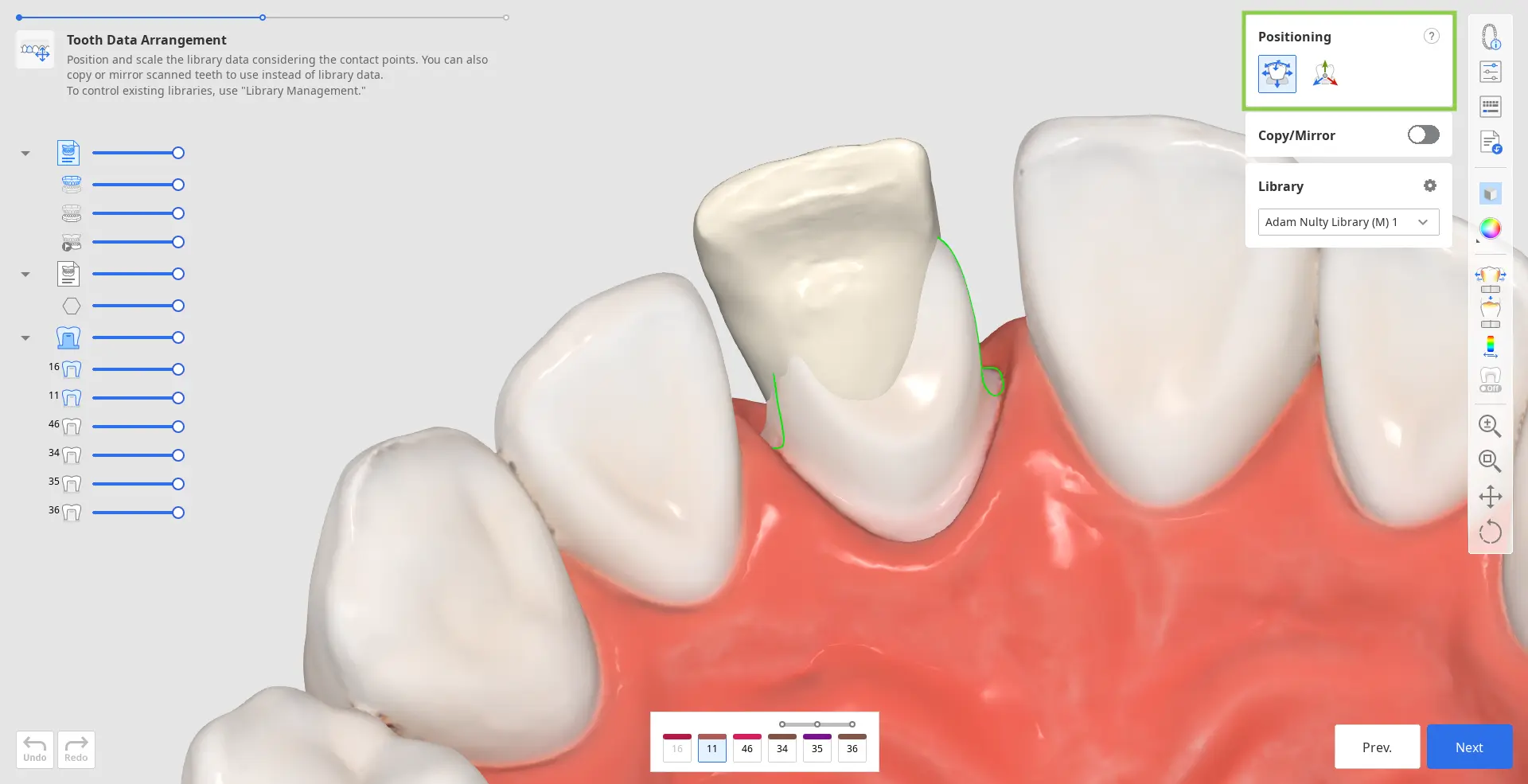 Prepared tooth_data_3.webp