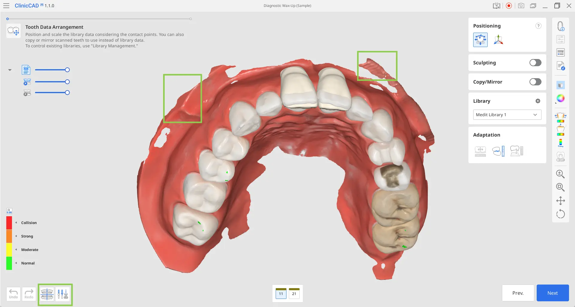 Diagnostic Wax-Up Module 3.webp