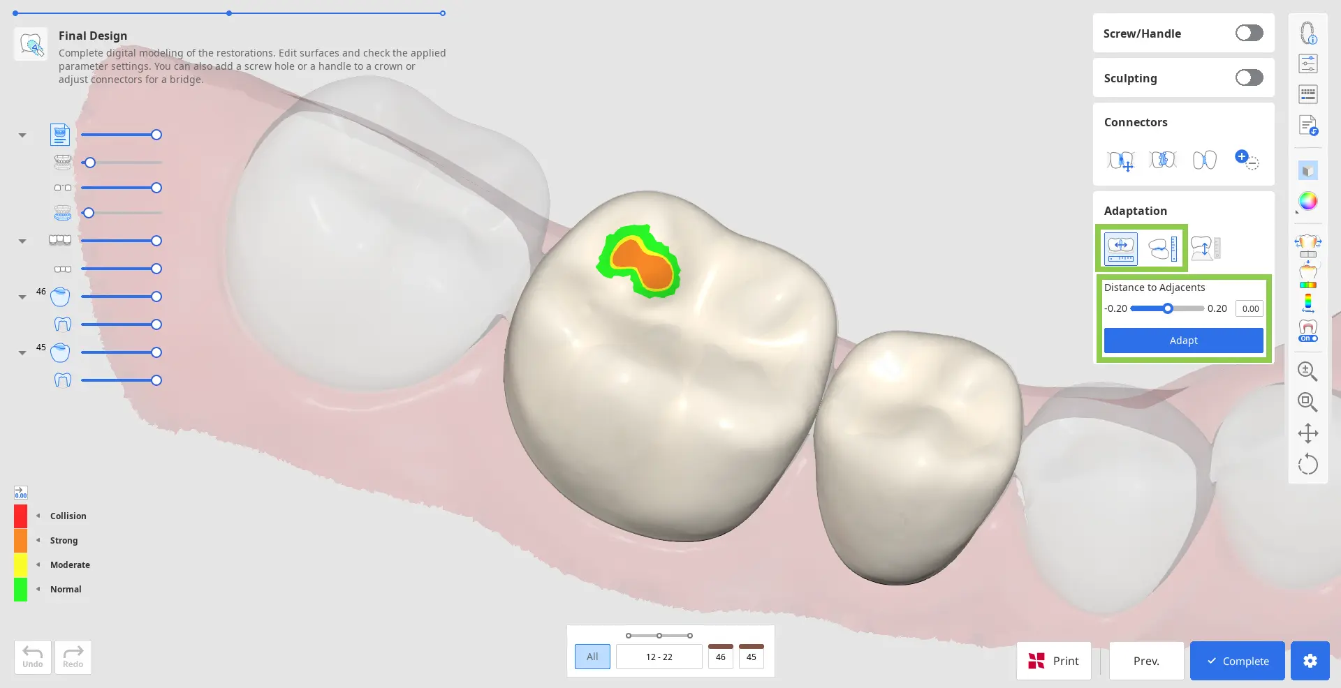 Pre Op final_design_3.webp