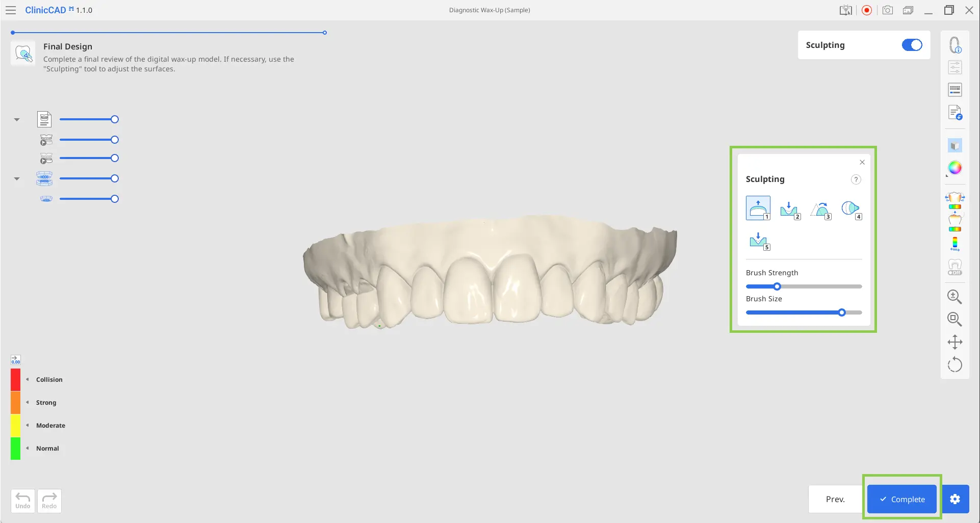 Diagnostic Wax-Up Module 8.webp