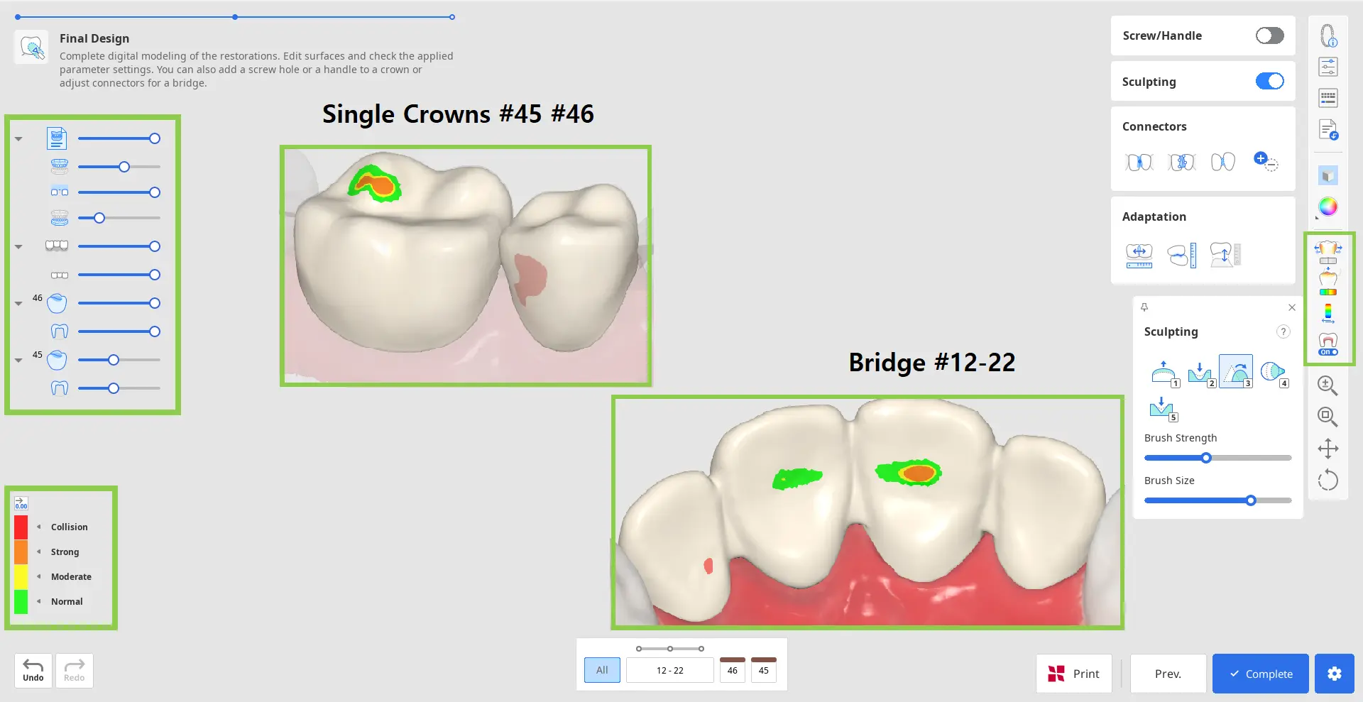 Pre Op final_design_1.webp