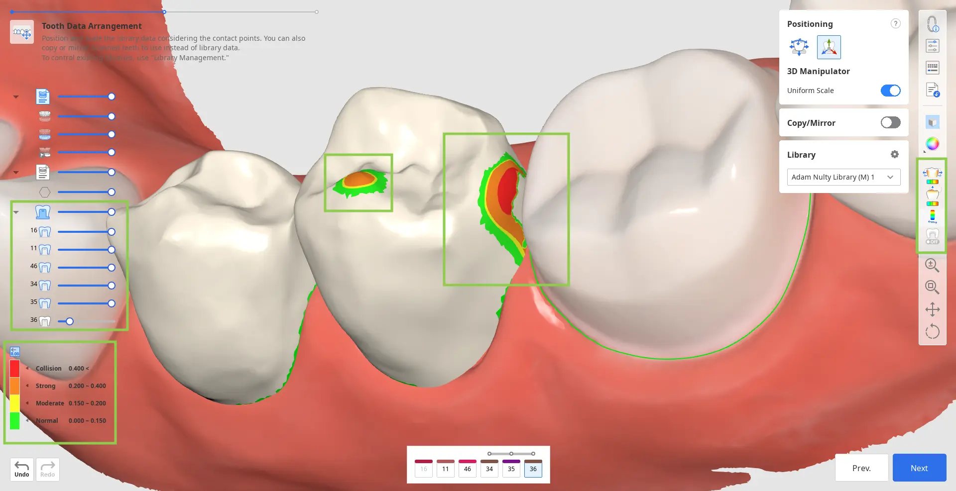 Prepared tooth_data_4.webp