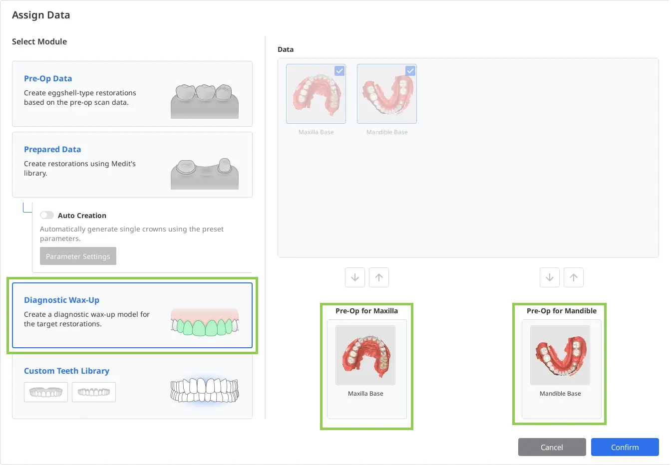Diagnostic Wax-Up Module 2.webp