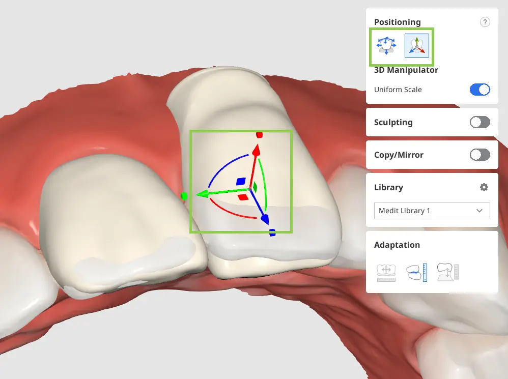 Diagnostic Wax-Up Module 5.webp