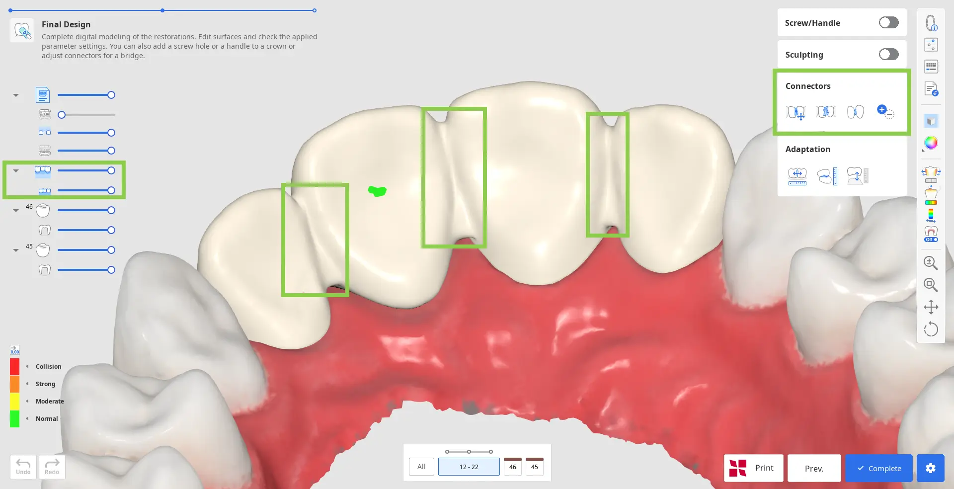 Pre Op final_design_4.webp