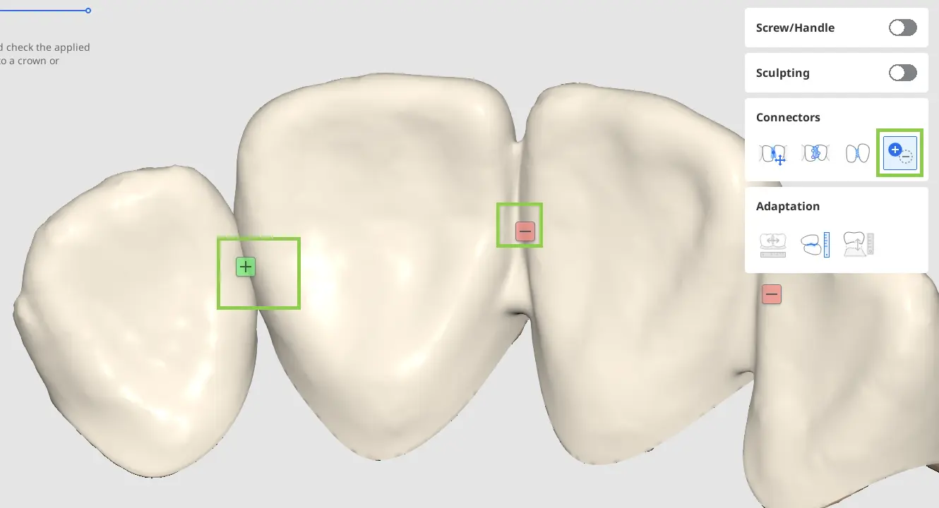 Pre Op final_design_4 4.webp