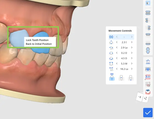 Move tooth Auravue 3.webp