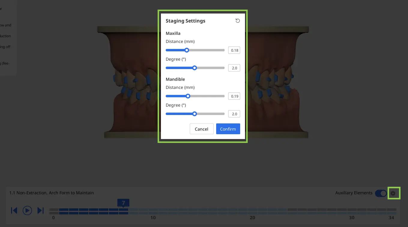 Aligners Auravue 2.webp