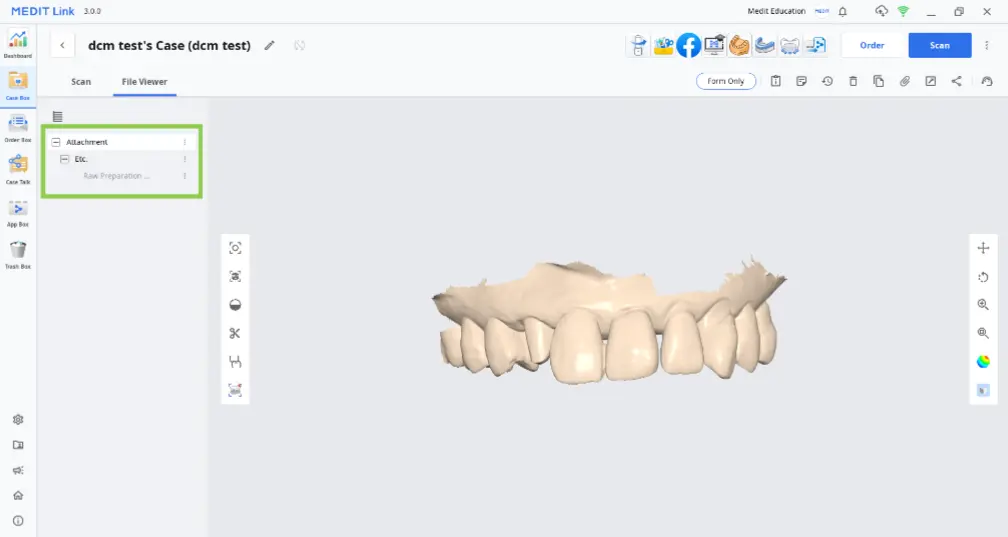 Attaching DCM files 2.webp