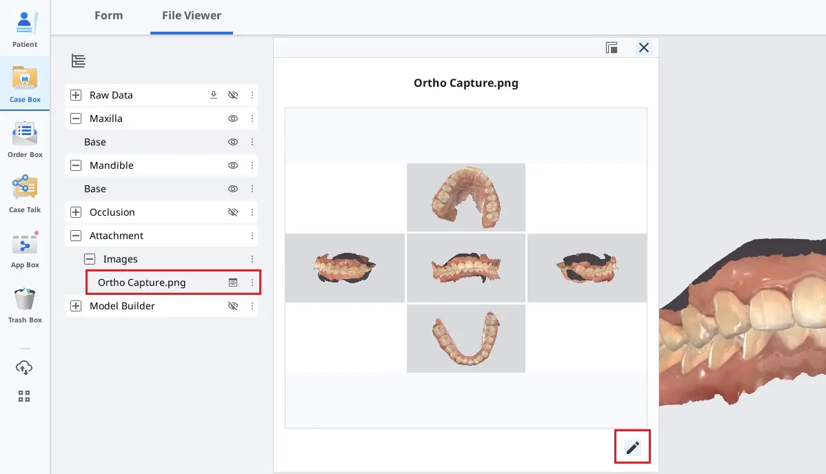 Ortho Capture.webp