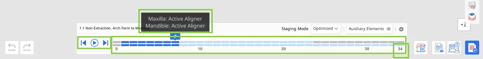 aligners_2.webp