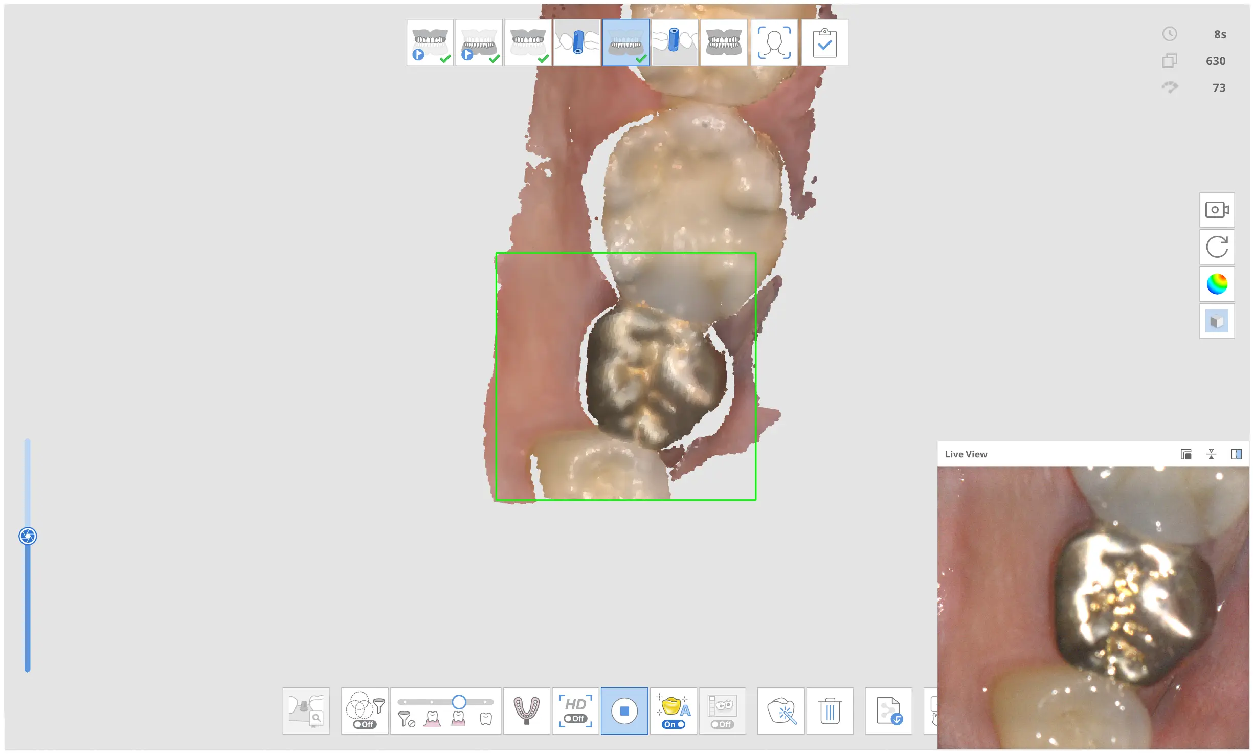 Metal scan 1.webp
