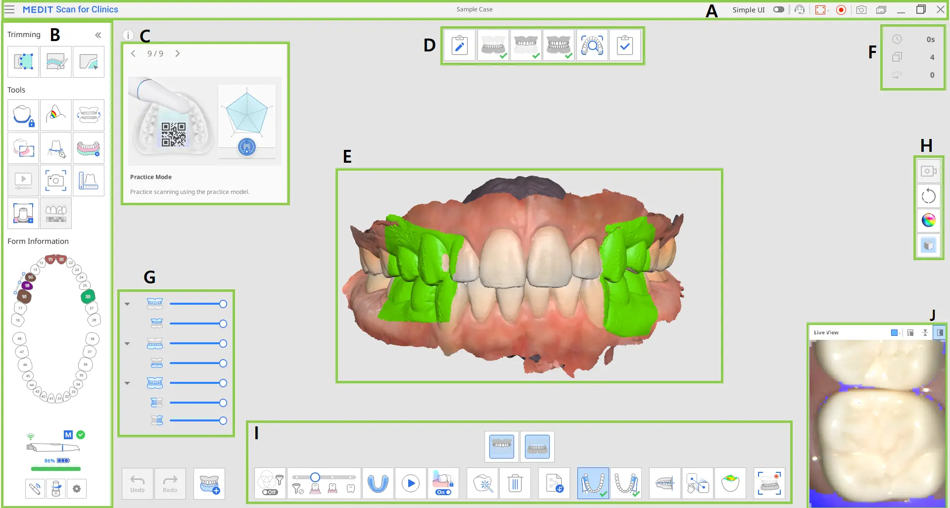Medit Scan for Clinics User Interface Overview.webp