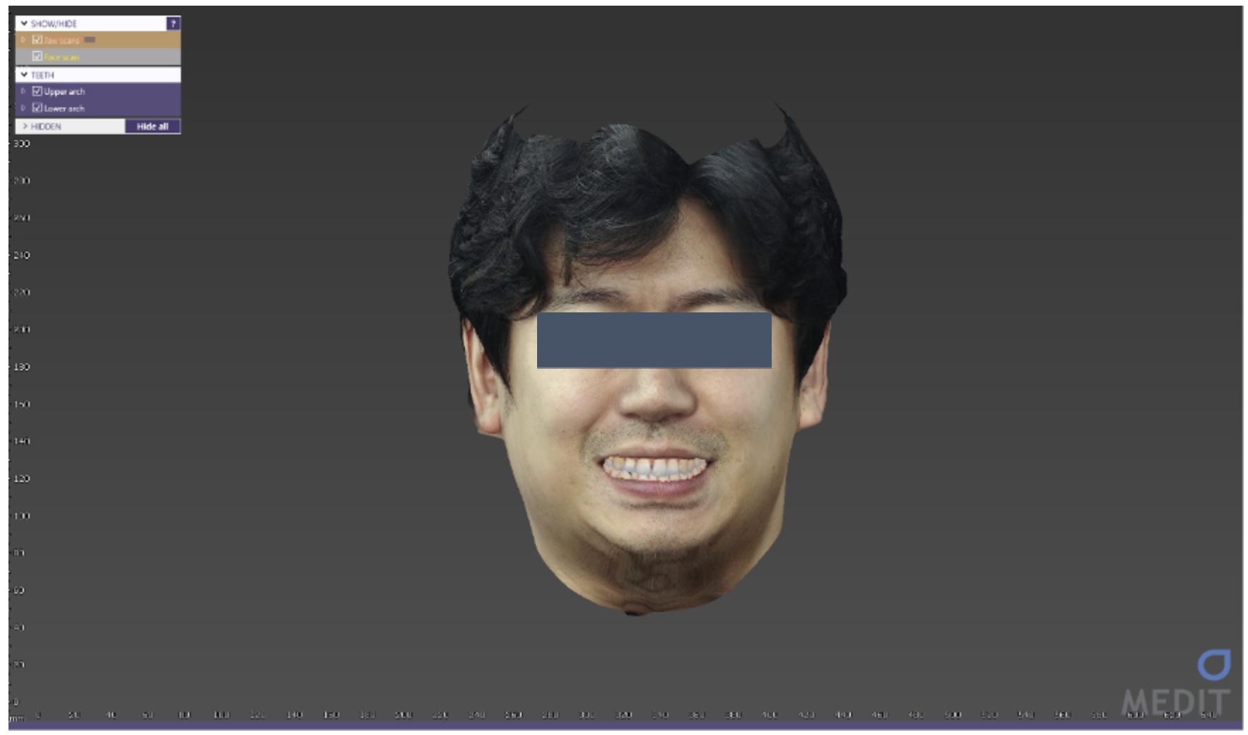 1.8_face_scan_13.png